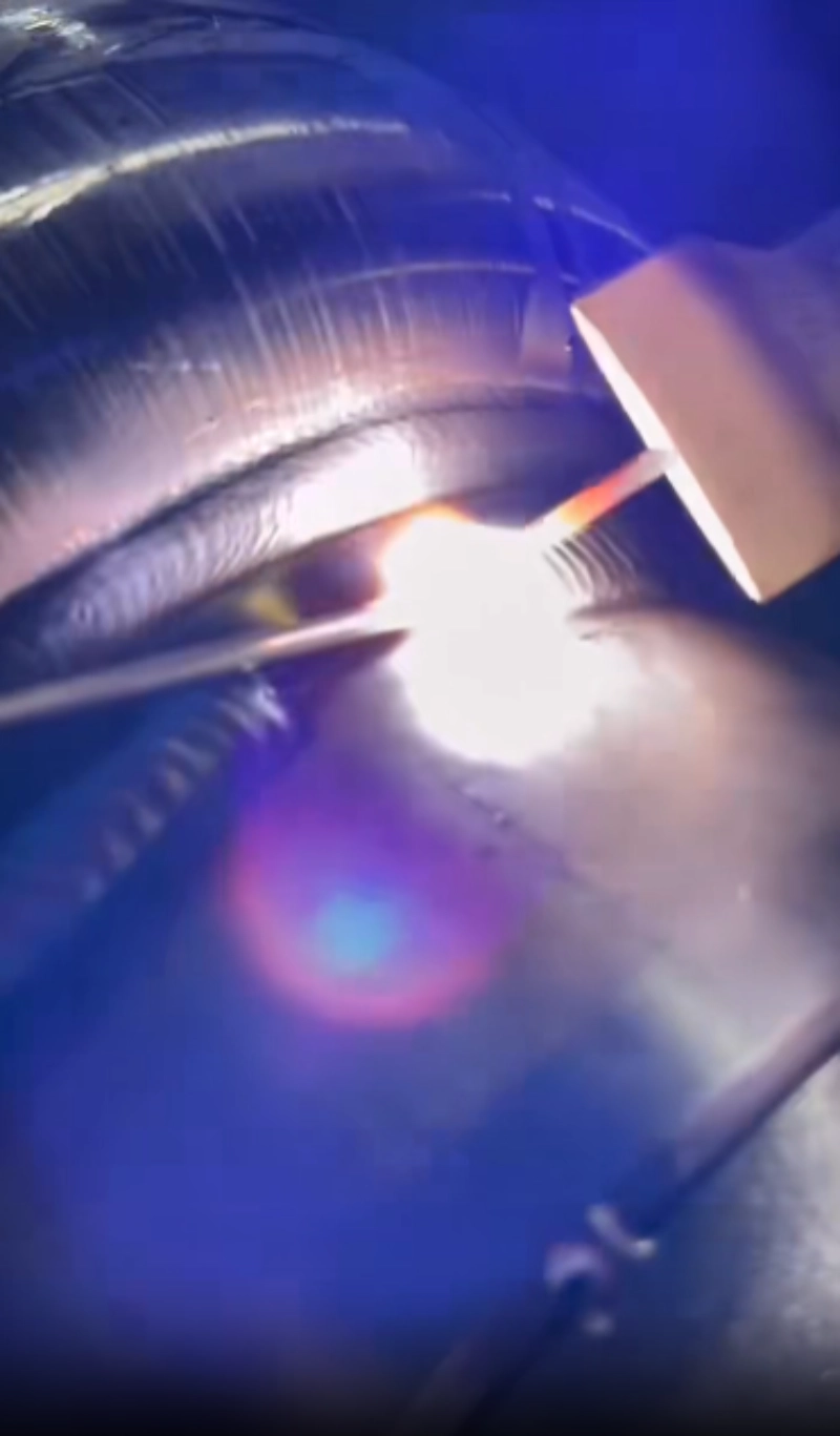 TIG Welding
